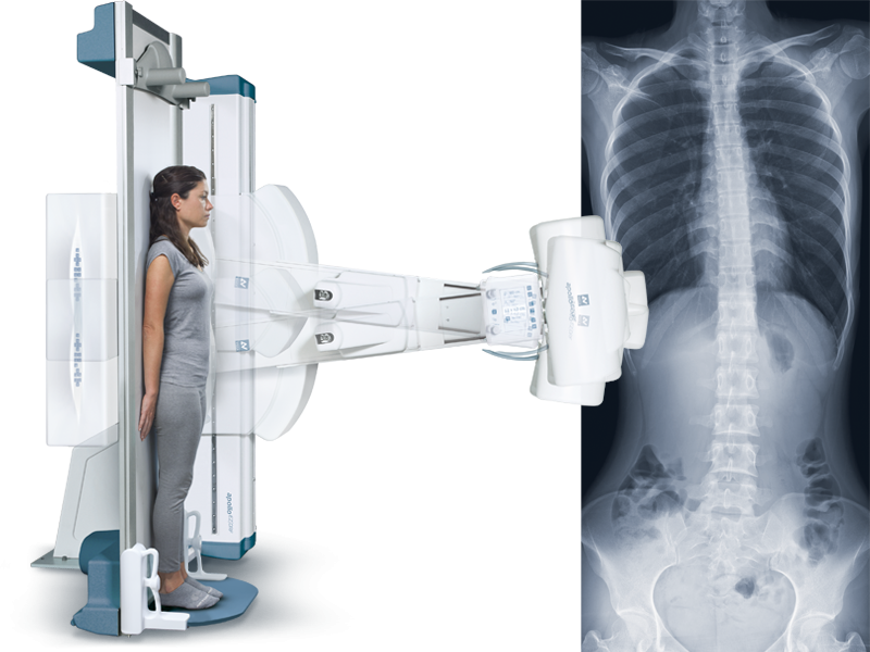 Great versatility for radiographic applications